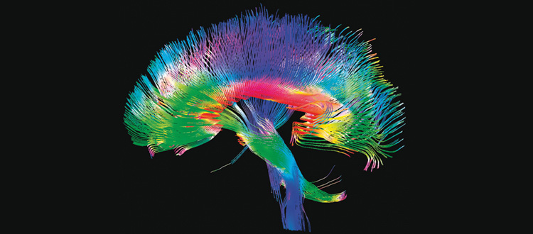 soirée et post-graduée connectome enfant cognitif